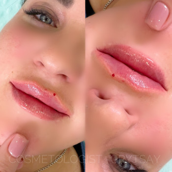 Корекція форми 