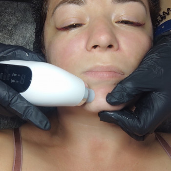 Гідропілінг
                    Салон краси Flower lady Черкаси