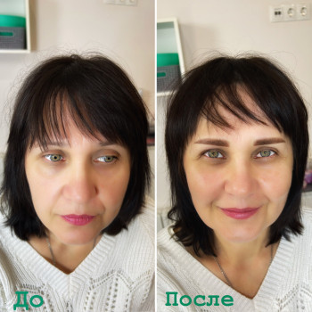 Брови до та одразу після процедури