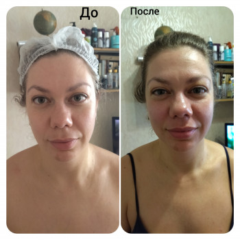 Скульптурирующий массаж лица, шеи и декольте