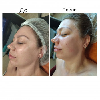 Скульптурирующий массаж лица, шеи и декольте