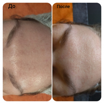 Скульптурирующий массаж лица, шеи и декольте