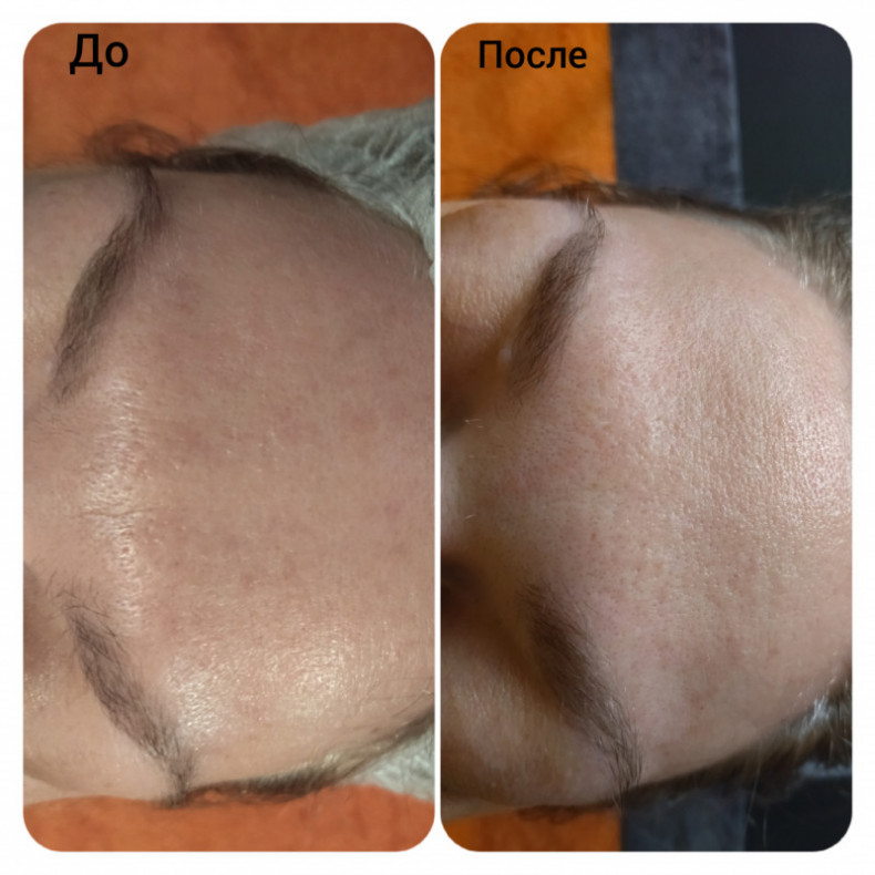 Скульптурирующий массаж лица, шеи и декольте, фото - Масажист Анна Юрьєва