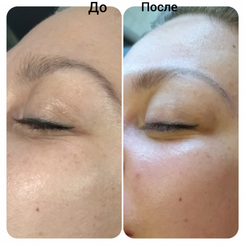 Скульптурирующий массаж лица, шеи и декольте, фото - Масажист Анна Юрьєва