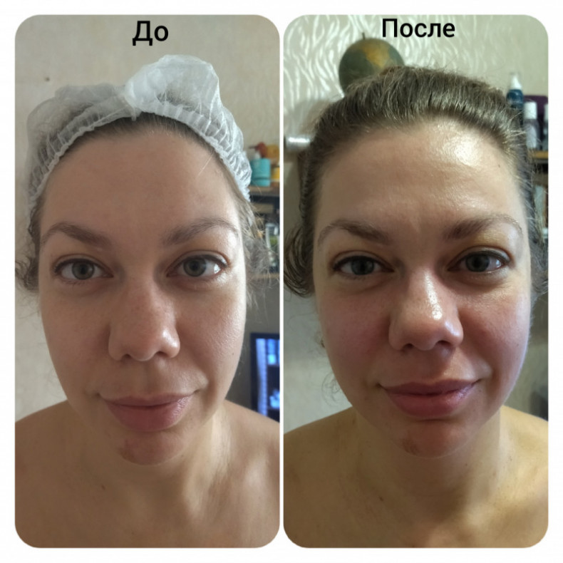 Скульптурирующий массаж лица, шеи и декольте, фото - Масажист Анна Юрьєва