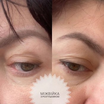 Аліна Дорошина, Киев Фото - 29