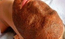 Маска из живого колагену морських водоростей Косметолог-естетист Інна Черкаси