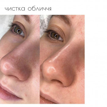 Наталія Урбіях, Житомир Фото - 10