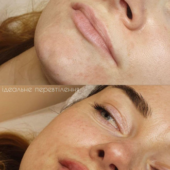 Наталія Урбіях, Житомир Фото - 14