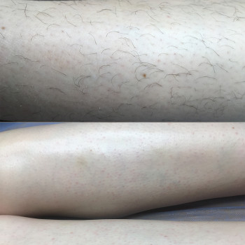 Вікторія Авдєєва, Кропивницкий Фото - 62