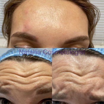 Наталія Книженко, Київ Фото - 29