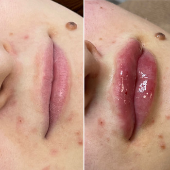 Наталія Книженко, Київ Фото - 33