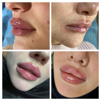 Наталія Книженко, Київ Фото - 34