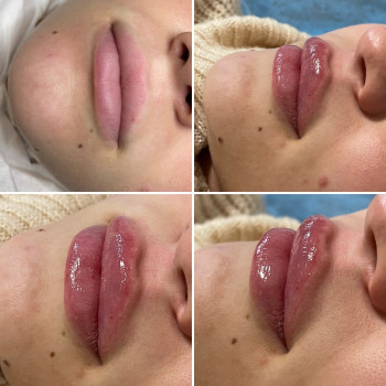 Наталія Книженко, Київ Фото - 37