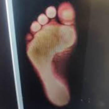 Фото з портфоліо фахівця Руслана Гончарова (подолог, Одеса)