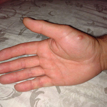 Фото з портфоліо фахівця Руслана Гончарова (подолог, Одеса)