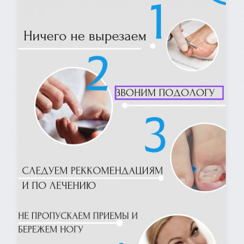 Фото з портфоліо фахівця Руслана Гончарова (подолог, Одеса)