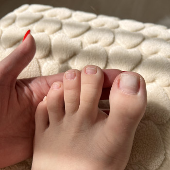 Надсилай фото, фото - подолог Руслана Гончарова