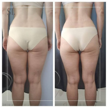 Кавітація
                    Салон красоты Slim Line Белая Церковь