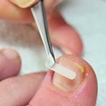 Коррекционная система bs
                    Подолог Руслана Петровна Одесса