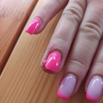 Лечение панариция
                    Подолог Руслана Петровна Одесса