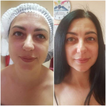 Наталя Кудряшова, Чернівці Фото - 27