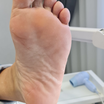 Педикюр аппаратный
                    Подолог Руслана Петровна Одесса