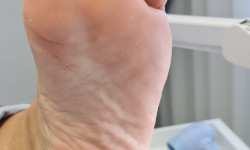 Педикюр аппаратный Подолог Руслана Петровна Одесса