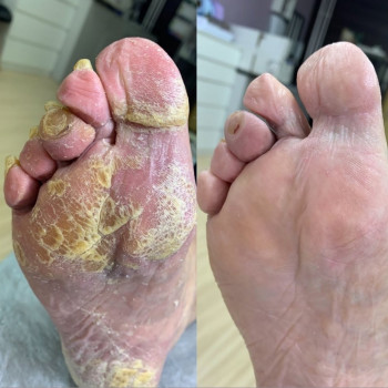 Мужской педикюр
                    Подолог Руслана Петровна Одеса