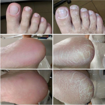 Мужской педикюр
                    Подолог Руслана Петровна Одеса