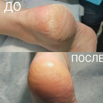 Мужской педикюр
                    Подолог Руслана Петровна Одеса