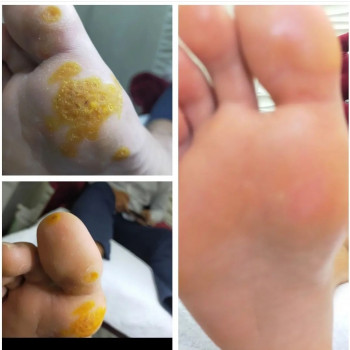 Мужской педикюр
                    Подолог Руслана Петровна Одеса