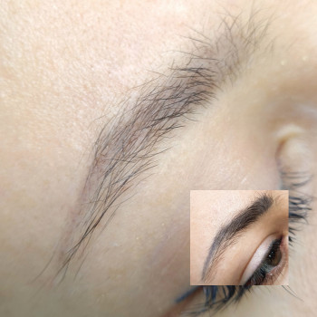 Лазерное удаление татуажа
                    Майстер перманентного макіяжу Лилия Київ