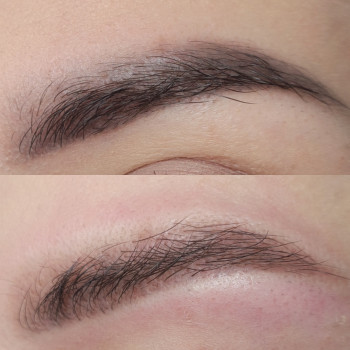 Лазерное удаление татуажа
                    Майстер перманентного макіяжу Лилия Київ