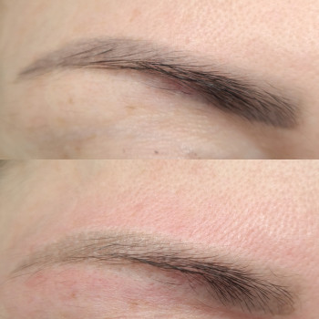 Лазерное удаление татуажа
                    Майстер перманентного макіяжу Лилия Київ