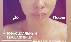 Лифтинг массаж лица (миофасциальный) Косметолог Елена Одеса