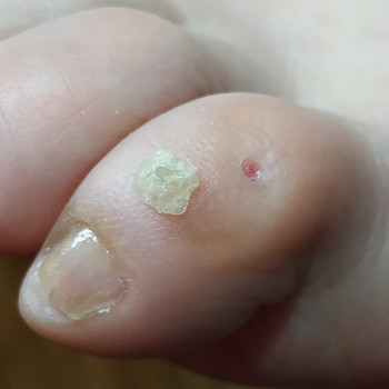 Оксана Коваленко, Харьков Фото - 3