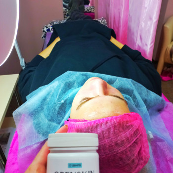 Комплекс Ультразвукова чистка + Карбокситерапія
                    Косметолог Лілія Винница