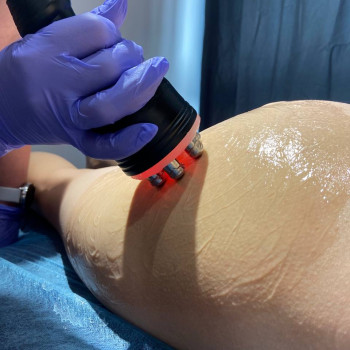 Вакуум/Rf-ліфтинг ноги/сідниці+бедра/живіт+боки 60 хв
                    Салон краси Fayna Stories Київ