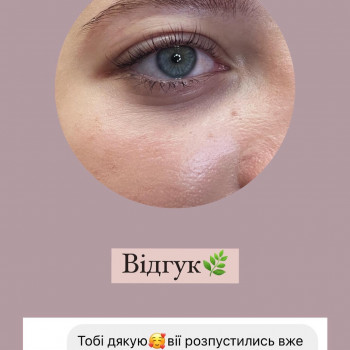 Ламінування вій
                    Косметолог-естетист Татьяна Хмельницький