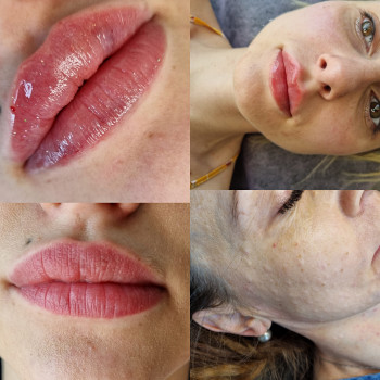 Олександра Левіна, Софиевская Борщаговка Фото - 5