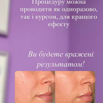 коррекция фигуры, коррекция морщин