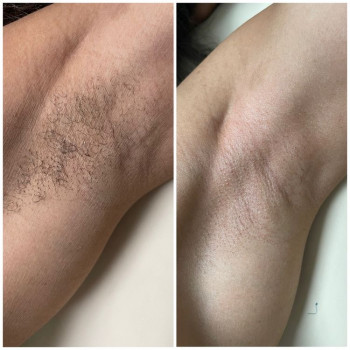 Владлена Горобей, Киев Фото - 4