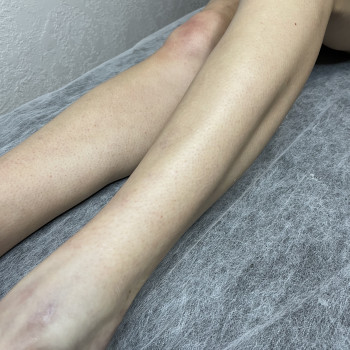 Владлена Горобей, Киев Фото - 6