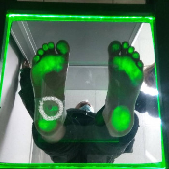 Диагностика на плантоскопе