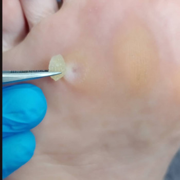 Тетяна Федченко, Харьков Фото - 11