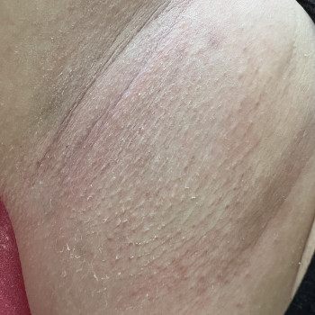 Марина Клинковська, Белая Церковь Фото - 5