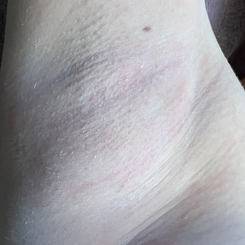 Марина Клинковська, Белая Церковь Фото - 7