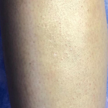 Марина Клинковська, Белая Церковь Фото - 9