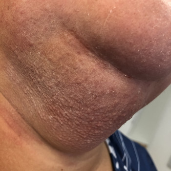 Марина Клинковська, Белая Церковь Фото - 11